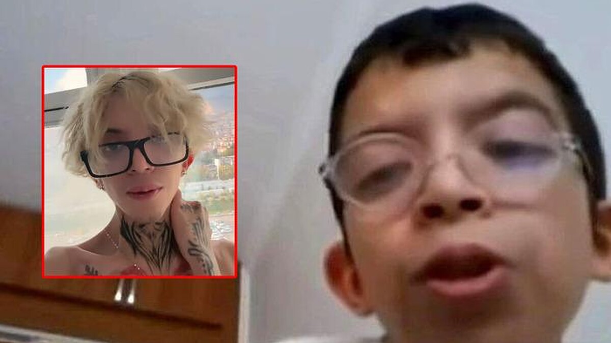 'Tablet Reis'in Estetik Operasyon Sürprizi! Kestirdim Ama Cinsiyet Değişimi Yokmuş'