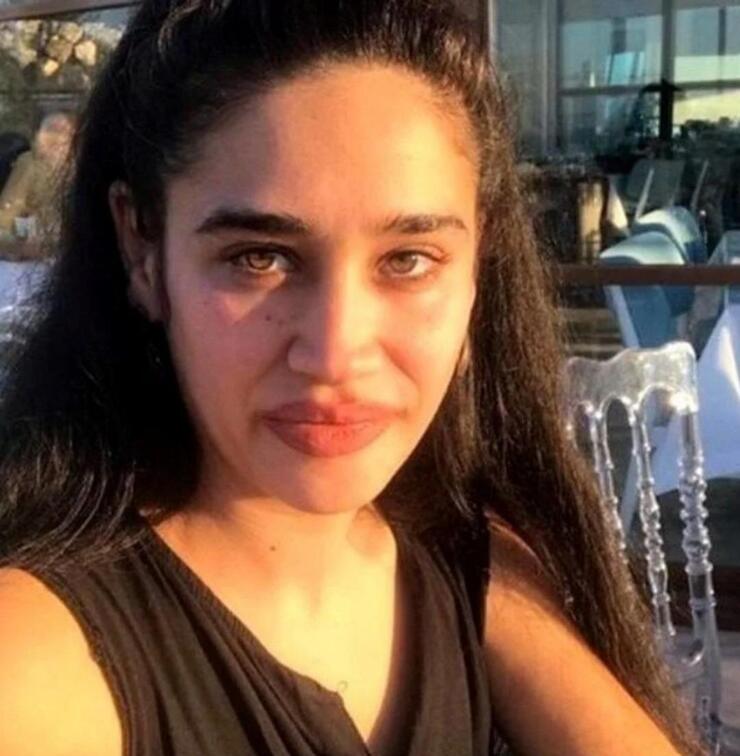 Meltem Miraloğlu'nun Amerikalı erkek tarafından darp edildiği iddiasıyla ilgili yeni detaylar!