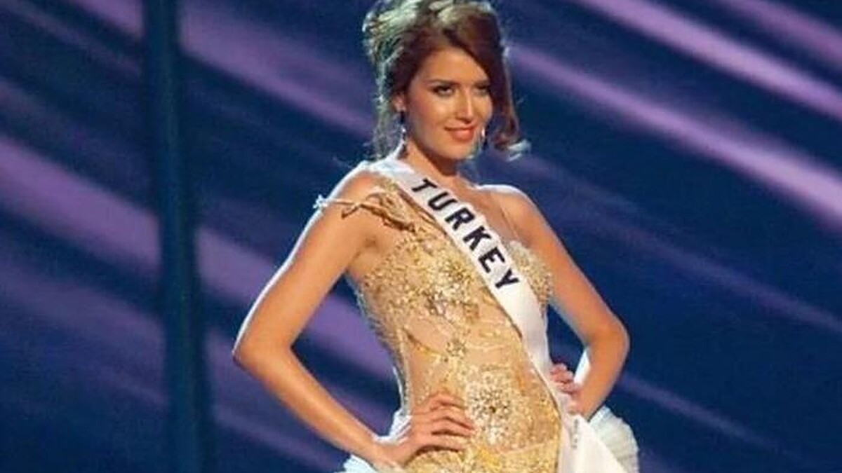 Eski Türkiye güzeli Senem Kuyucuoğlu elektrik sobası faciasıyla korkuttu