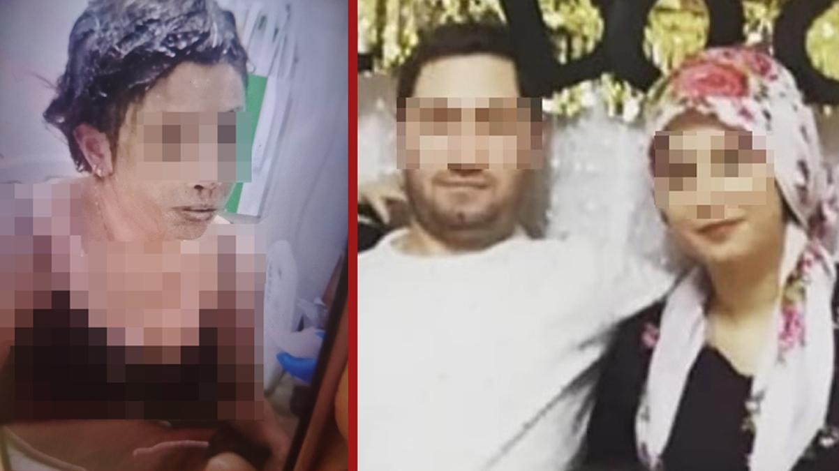 Gaziantep'te Vahşet: Boşandığı Eşini Bağlayıp Kezzap Döktü