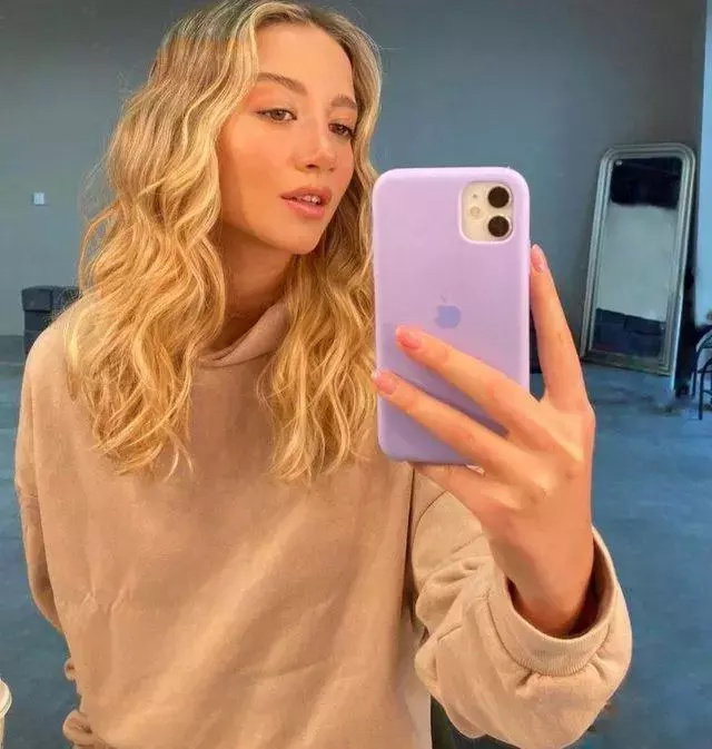 Survivor Yıldızı Aleyna Kalaycıoğlu Estetik Sonrası Tanınmadı