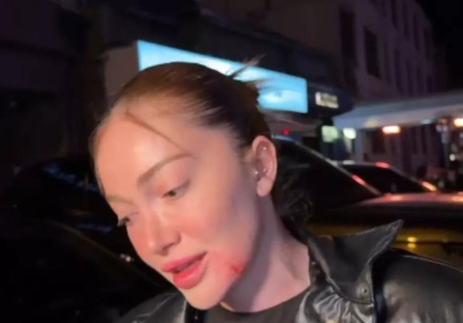 Danla Bilic’i Darp Eden Eski Sevgilisi Hapse Mahkum Oldu