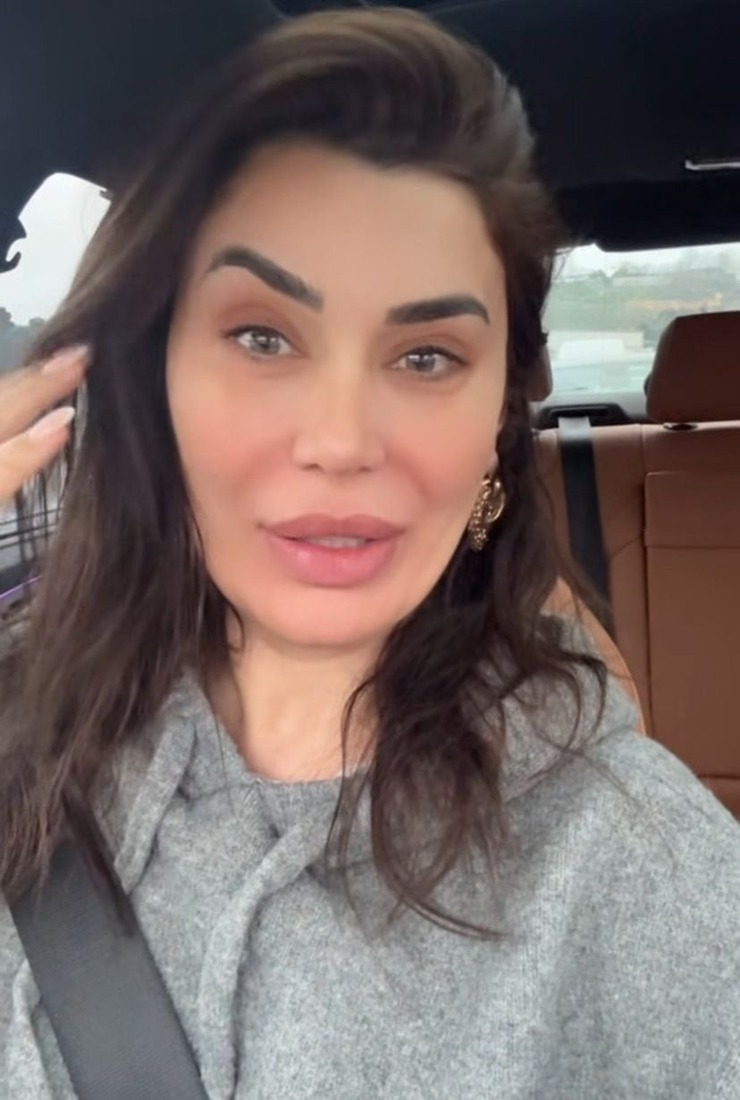 Ebru Şancı’nın Botoks Sonrası Tek Kaşı Havada Kaldı