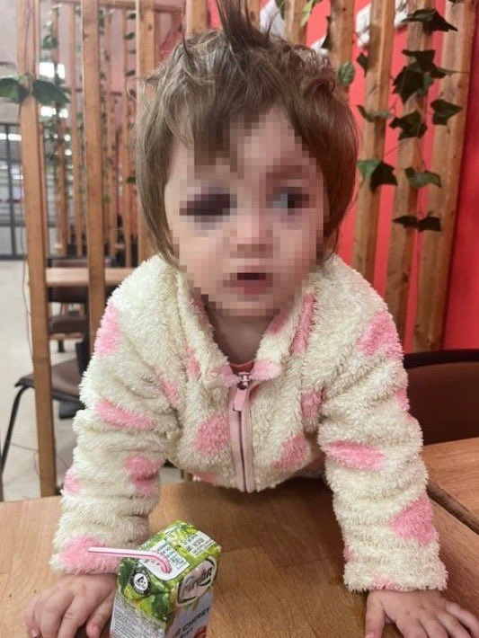 İkra Bebeğin Yaralandığı Kavgada Şüphelilerin İfadeleri Ortaya Çıktı