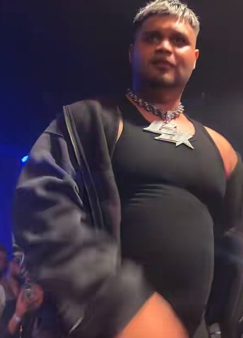 Lvbel C5 Böbrek Rahatsızlığı Nedeniyle Ödem Yaşadığını Açıkladı