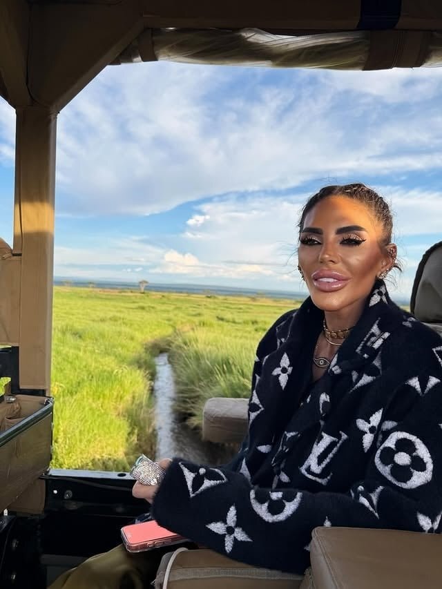 Süreyya Yalçın Safariden Paylaştığı Fotoğraflarla Endişe Yarattı