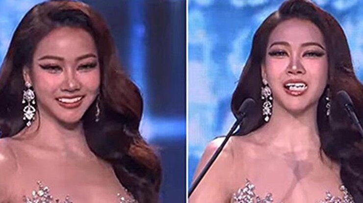 Kamolwan Güzellik Yarışmasında Takma Dişini Düşürdü Gülerek Toparlandı