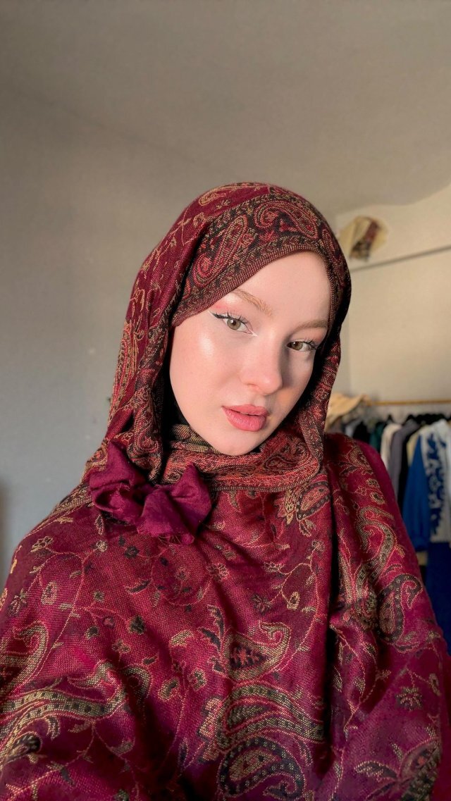 Fatma Soydaş'ın Estetik Öncesi Fotoğrafları Sosyal Medyayı Salladı