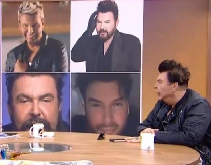 Kuşum Aydın Dolgu Sonrası Yüz Germe Ameliyatı Oldu