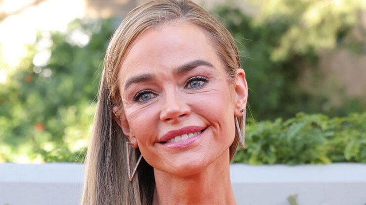 Denise Richards Estetik Operasyonlarını Cerrahıyla Birlikte Duyurdu