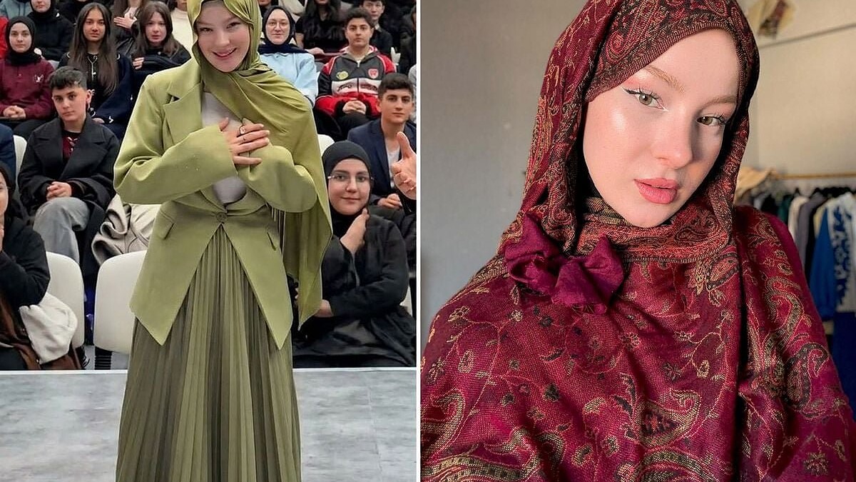 Fatma Soydaş'ın Estetik Öncesi Fotoğrafları Sosyal Medyayı Salladı