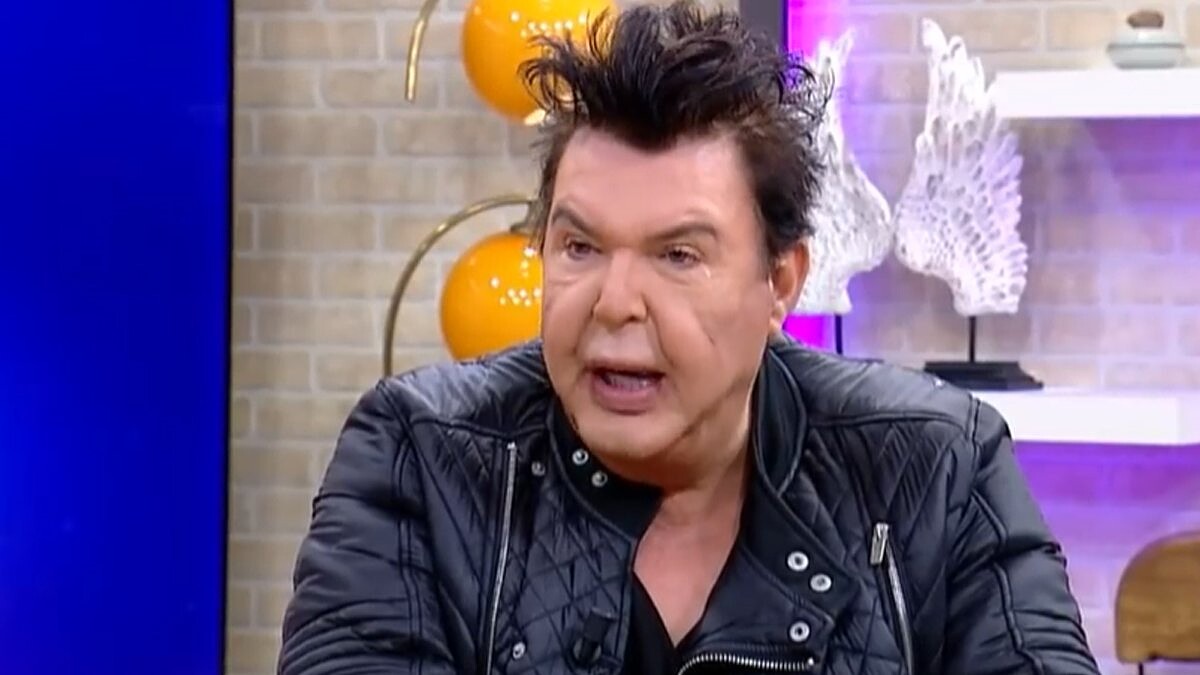 Kuşum Aydın Dolgu Sonrası Yüz Germe Ameliyatı Oldu