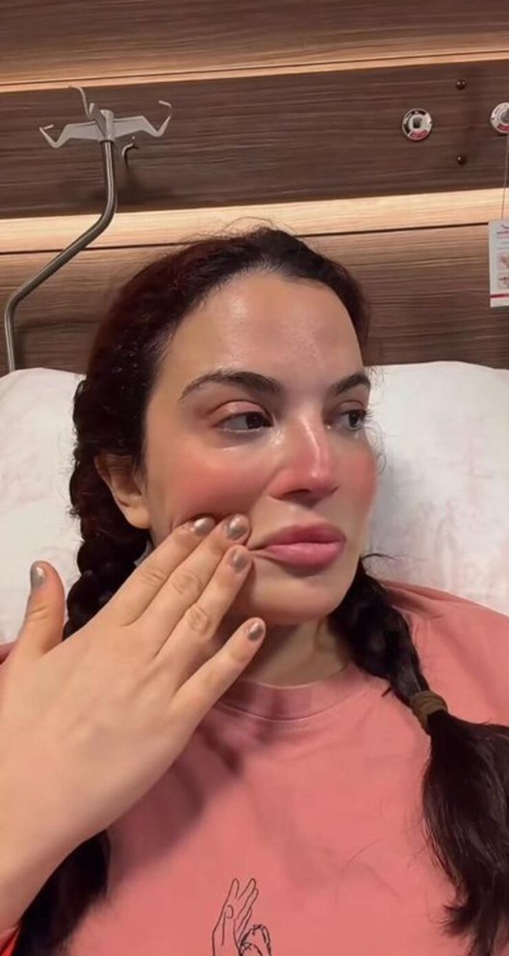Aslı Bekiroğlu 8 Ameliyat Sonrası Güldüren Paylaşım Yaptı