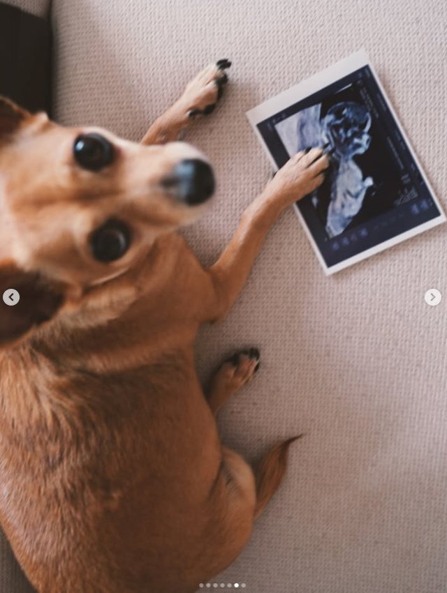Sude Burcu Ve Mert Öcal Bebek Bekliyor