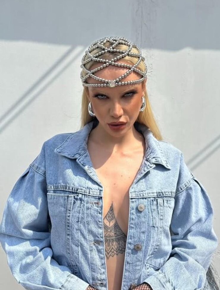 Ayşenur Balcı Estetik Sonrası Tanınmaz Hale Geldi