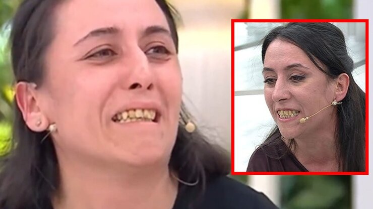 Derya Eşinin Hakaretlerine Rağmen Yeni Dişleriyle Ekrana Geldi