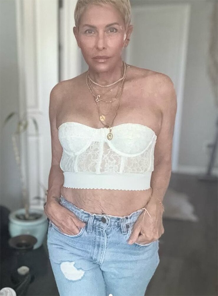 Nicole Eggert Kanser Tedavi Sürecini Sosyal Medyada Paylaştı