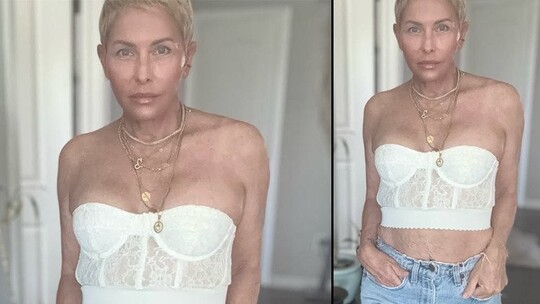 Nicole Eggert, meme kanseri tedavisinde mastektomi, kemoterapi ve histerektomi...