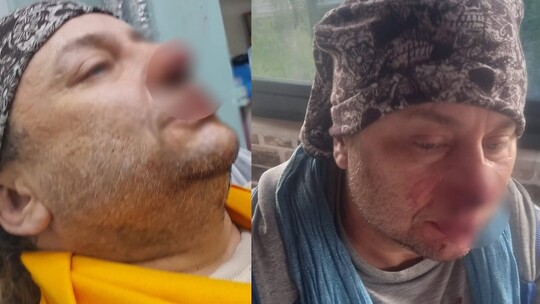 Ses sanatçısı Onur Akay, köpeği Leo'yu başıboş bir pitbullun saldırısından korurken...