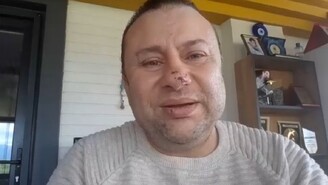 Onur Akay Pitbull Saldırısından Sonra Ölümden Döndüğünü Anlattı