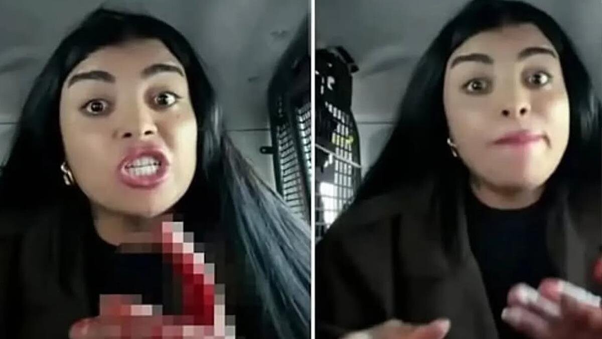 Tiktok Fenomeni Karagül Canlı Yayında Bıçaklı Saldırı Nedeniyle Gözaltına Alındı