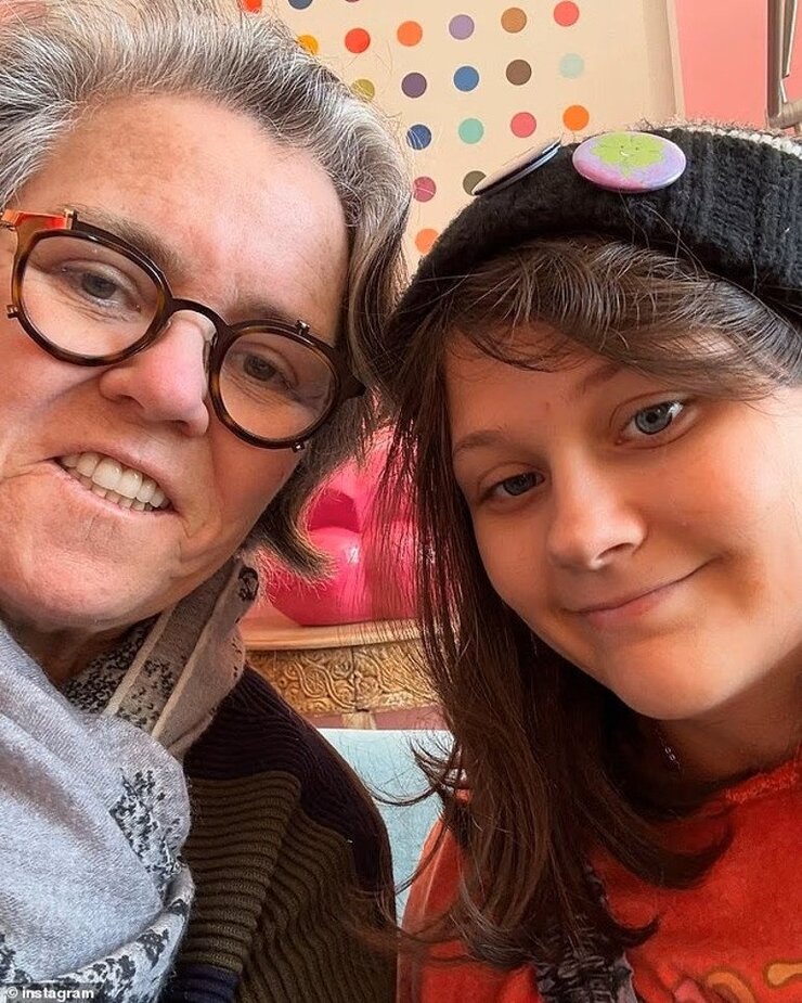 Rosie O'Donnell Yüz Gerdirme Ameliyatını İtiraf Etti