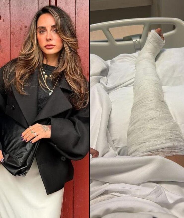 Yasemin Yürük Bacağındaki Platin Sonrası Ağrılarının Dinmediğini Açıkladı