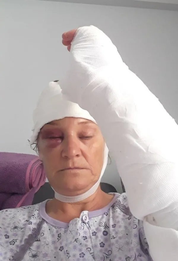 İzmir'de Köpek Saldırısına Uğrayan Emekli Polis Suç Duyurusunda Bulundu