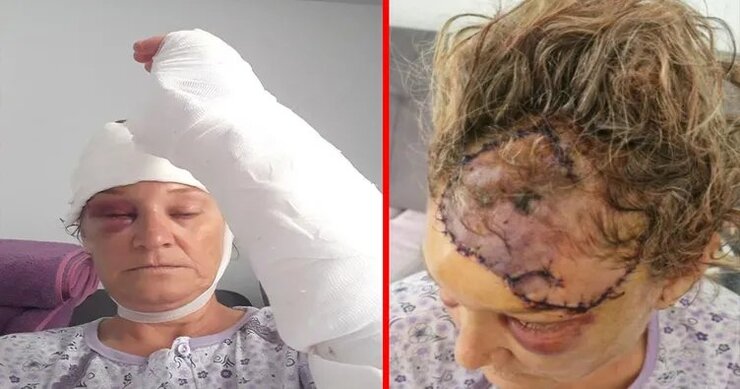 İzmir'de Köpek Saldırısına Uğrayan Emekli Polis Suç Duyurusunda Bulundu