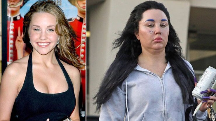 Amanda Bynes Mavi Kaşları Ve Sarı Saçlarıyla Los Angeles Sokaklarında Göründü