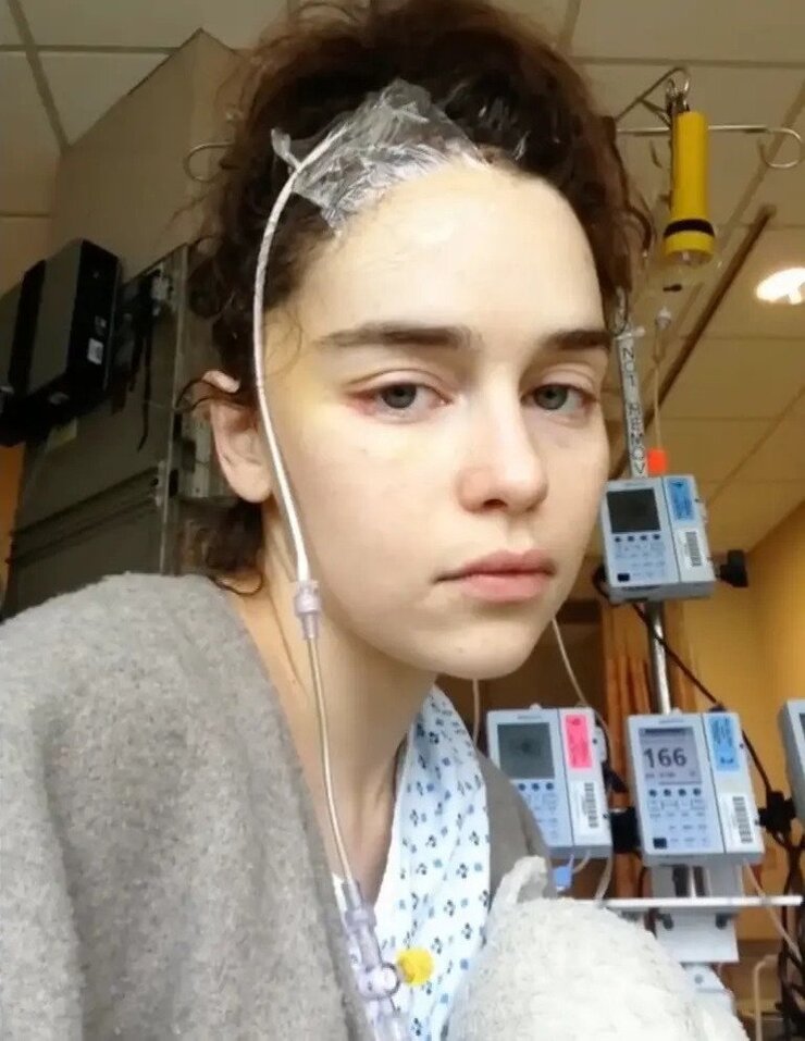 Emilia Clarke Oynarken İki Kez Beyin Kanaması Geçirdi