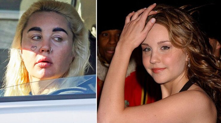 Amanda Bynes Mavi Kaşları Ve Sarı Saçlarıyla Los Angeles Sokaklarında Göründü