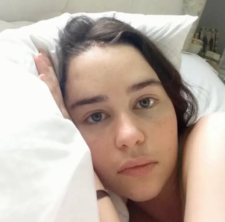 Emilia Clarke Oynarken İki Kez Beyin Kanaması Geçirdi