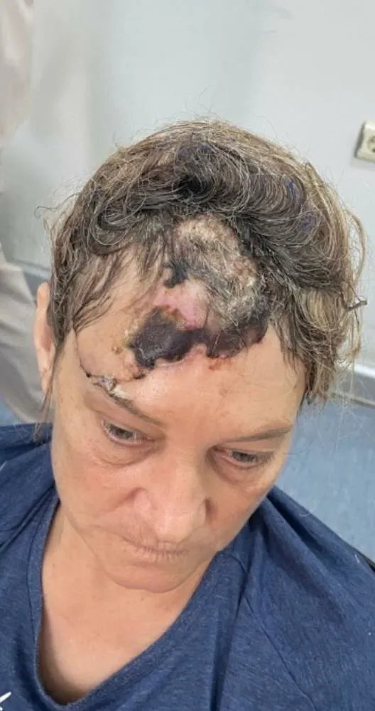 İzmir'de Köpek Saldırısına Uğrayan Emekli Polis Suç Duyurusunda Bulundu