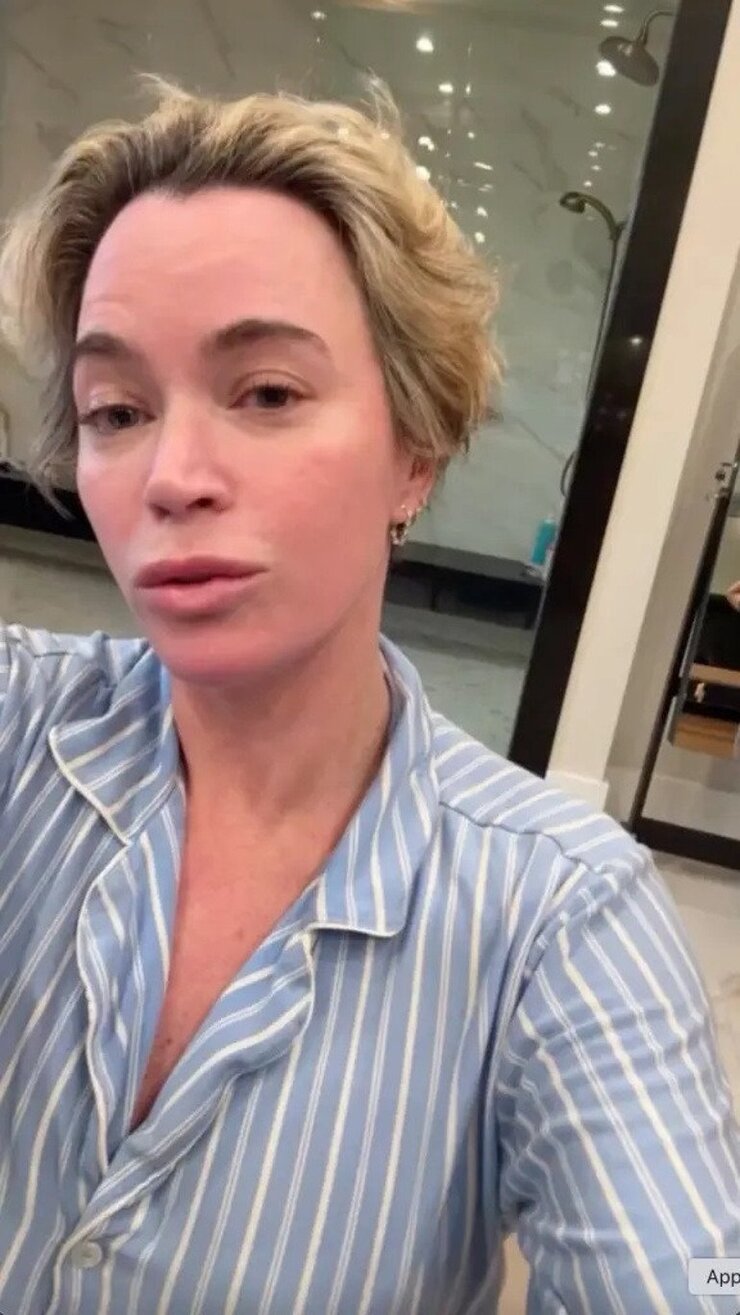 Teddi Mellencamp Ameliyat İzlerini Paylaşarak Kanser Yolculuğunu Anlattı