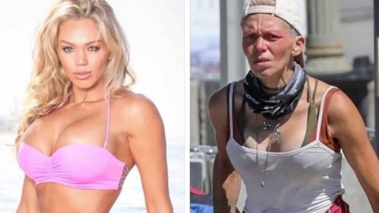 Eski Model Kimberley Willison Los Angeles Sokaklarında Çöpten Yiyecek Topluyor