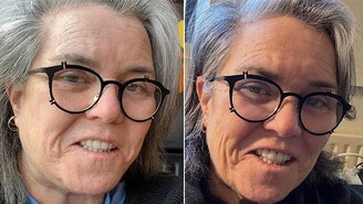 Rosie O'Donnell Yüz Gerdirme Ameliyatını İtiraf Etti