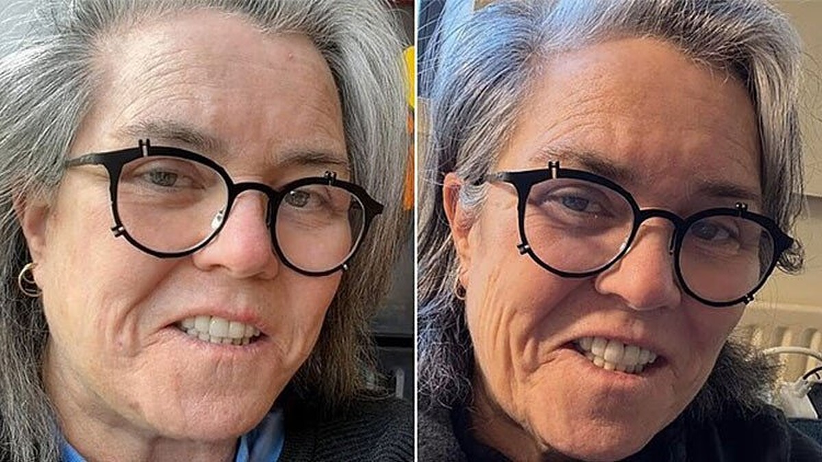 Rosie O'Donnell Yüz Gerdirme Ameliyatını İtiraf Etti