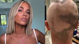 Teddi Mellencamp Ameliyat İzlerini Paylaşarak Kanser Yolculuğunu Anlattı