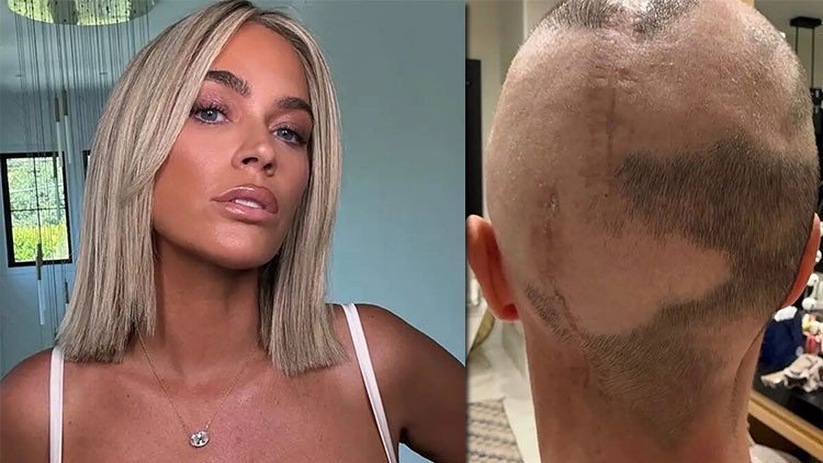 Teddi Mellencamp Ameliyat İzlerini Paylaşarak Kanser Yolculuğunu Anlattı