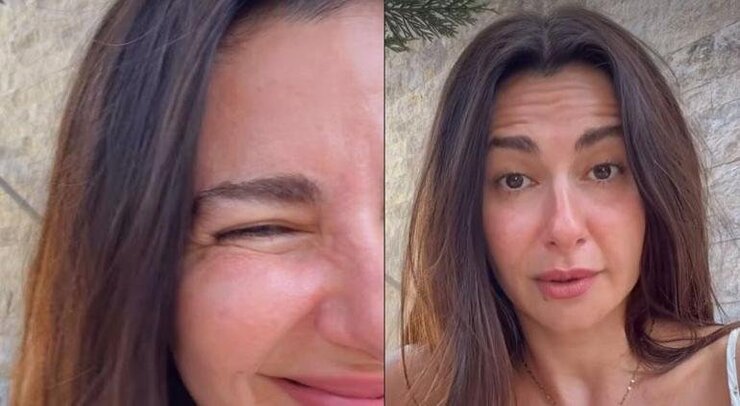 Nesrin Cavadzade Botoks İddialarına Sosyal Medyadan Yanıt Verdi